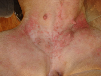 Flea bites (source: http://www.westcoastvet.co.nz/index.php?ps_page=newsletters&pi_newsletterid=2)