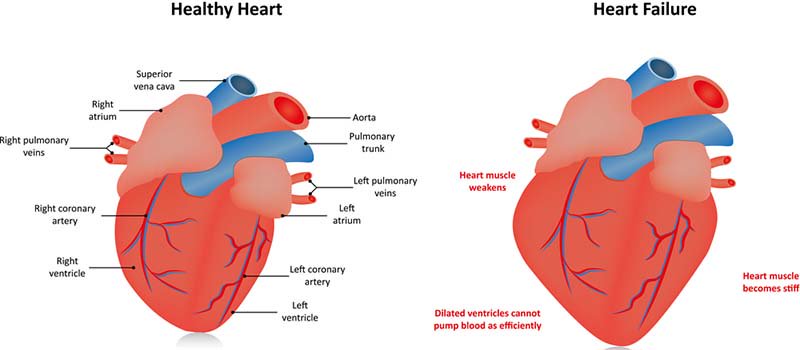 how to treat congestive heart failure in dogs