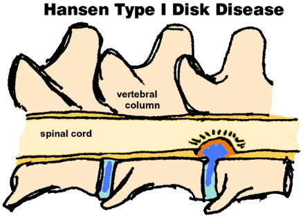 Hansen Type I IVDD in dogs. Intervertebral disc disease in dogs. IVDD in dogs. Bulging disc in dogs. ivdd dachshund. 
