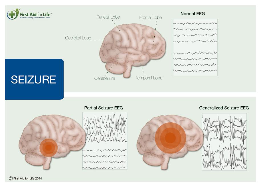 Epilepsy in dogs and cats. Dog seizures. Cat seizures. Epilepsy in cats