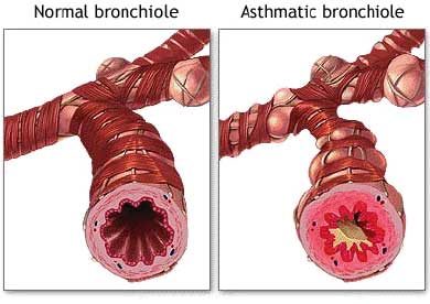 Air passages in the lungs. Feline asthma. Cat asthma