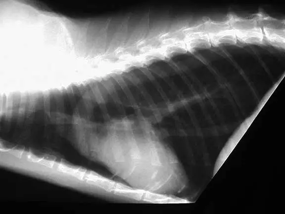 X Ray Of Lungs With Asthma