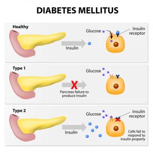 Diabetes in dogs - causes, symptoms, treatment & diet management