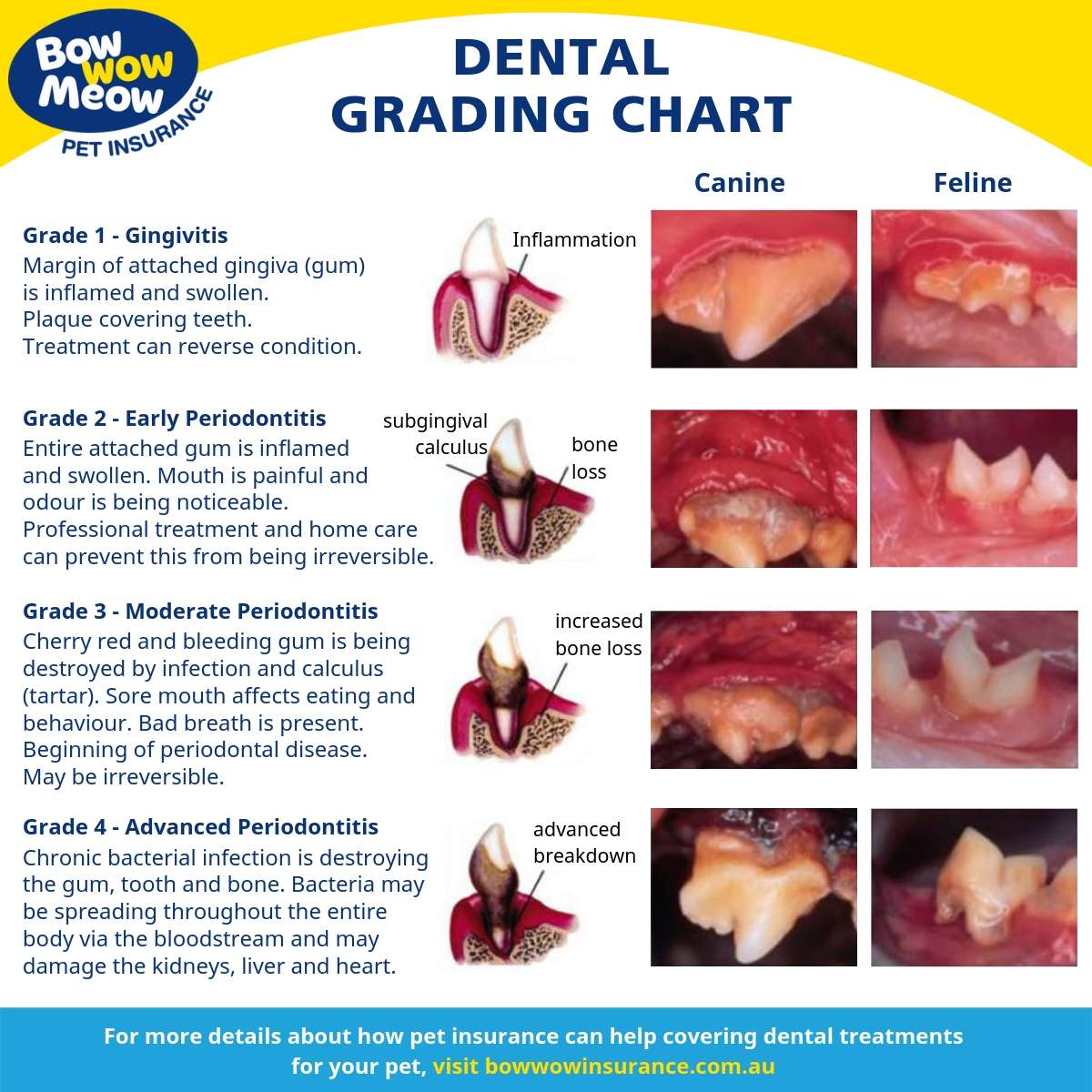 Dental Grade Chart