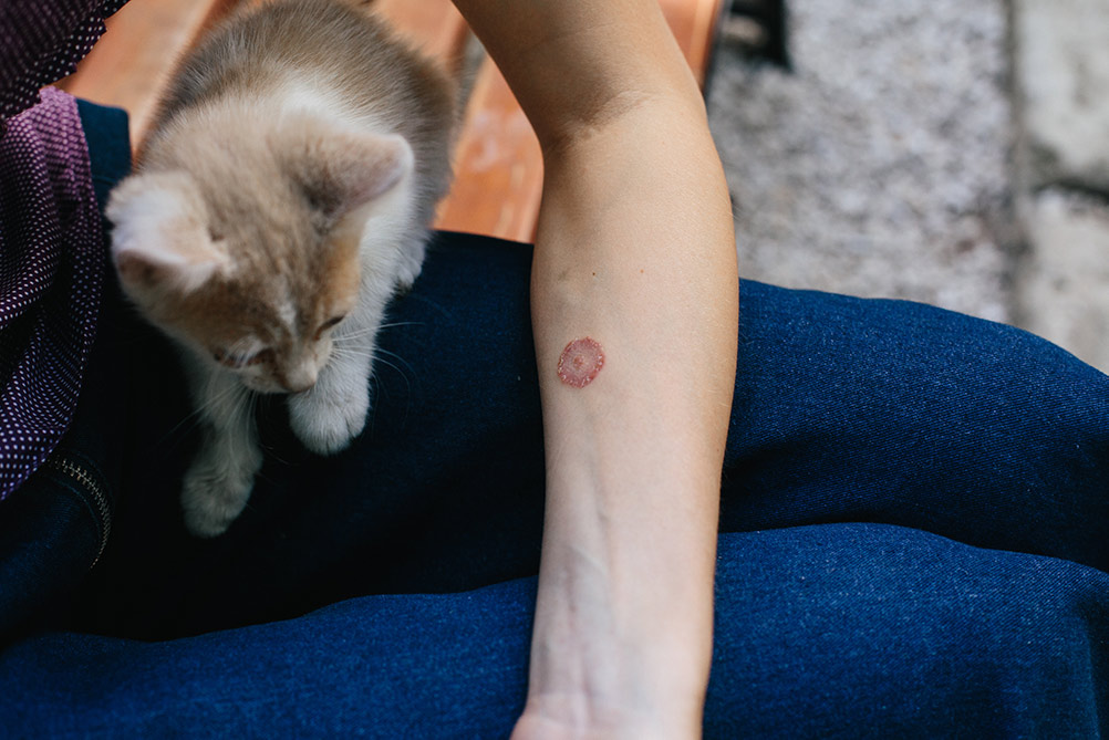 woman with ringworm infection and kitten sit next to her